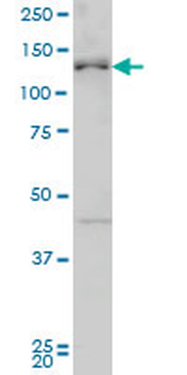 ABL2 Antibody in Western Blot (WB)