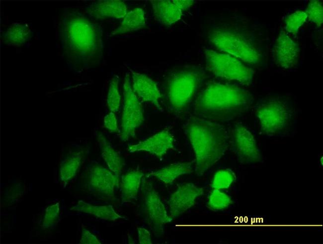 ABL2 Antibody in Immunocytochemistry (ICC/IF)