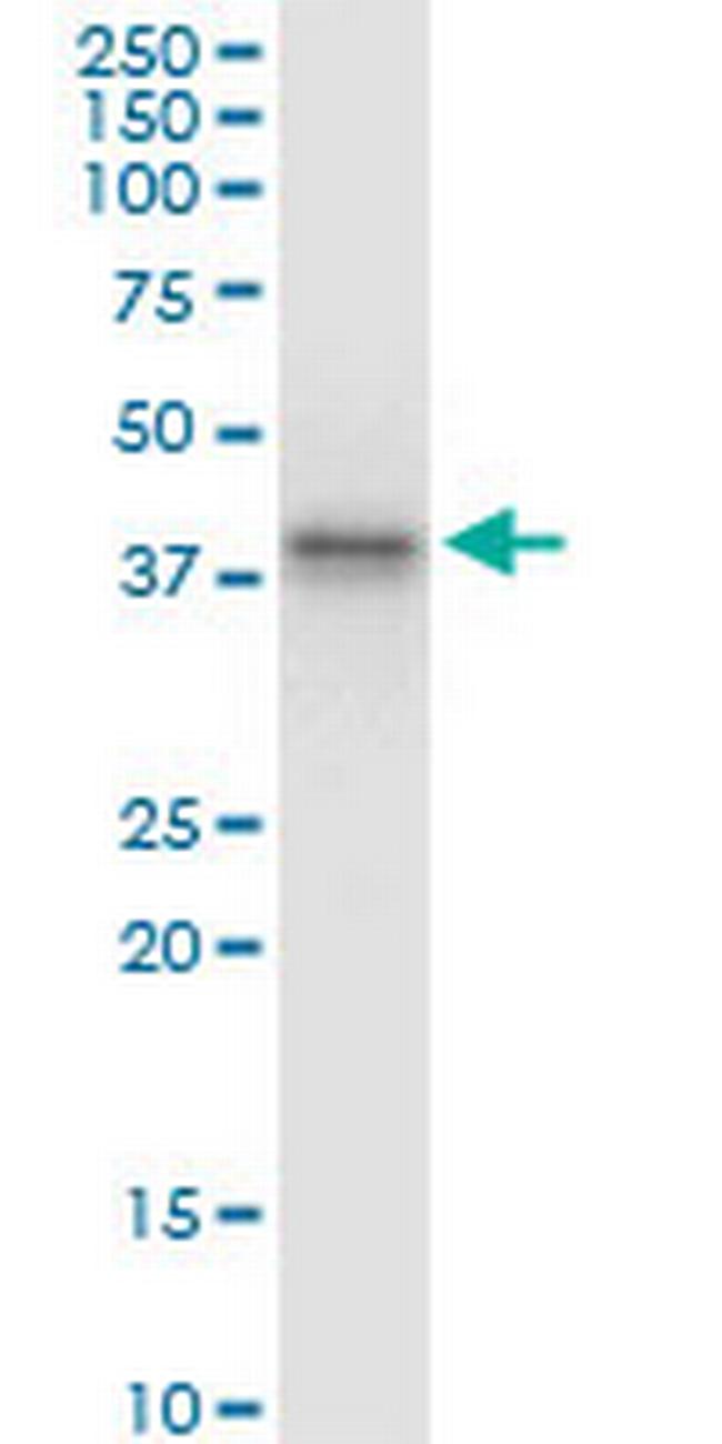 ABO Antibody in Western Blot (WB)