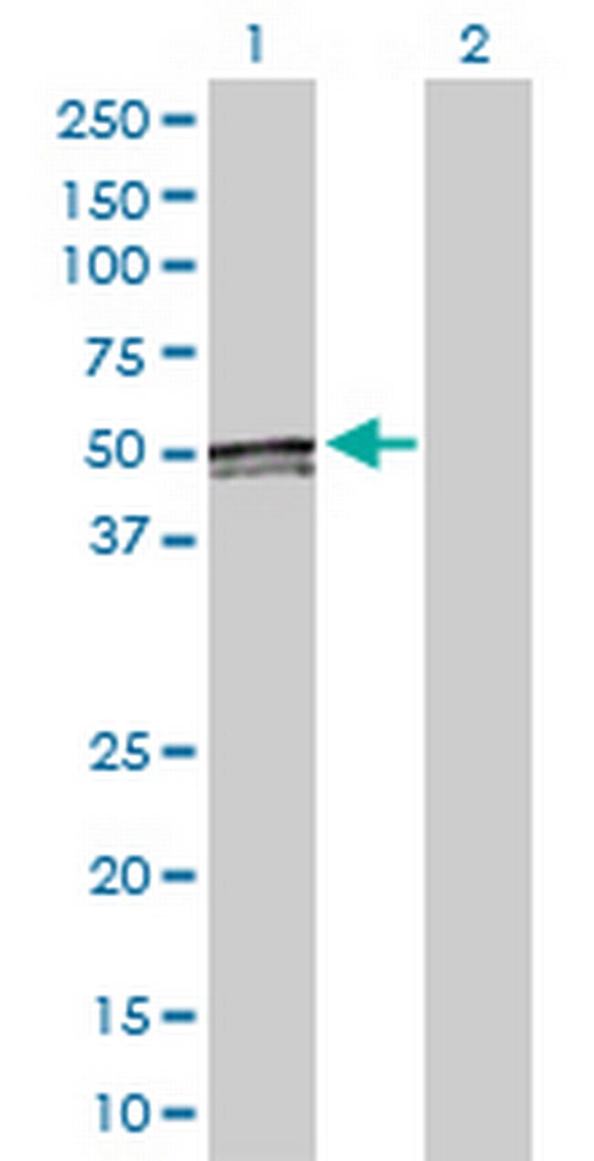 ACAA1 Antibody in Western Blot (WB)