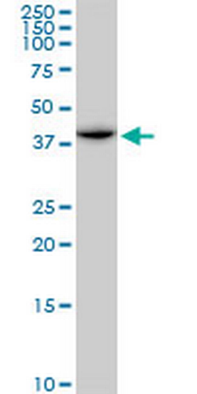 ACADM Antibody in Western Blot (WB)