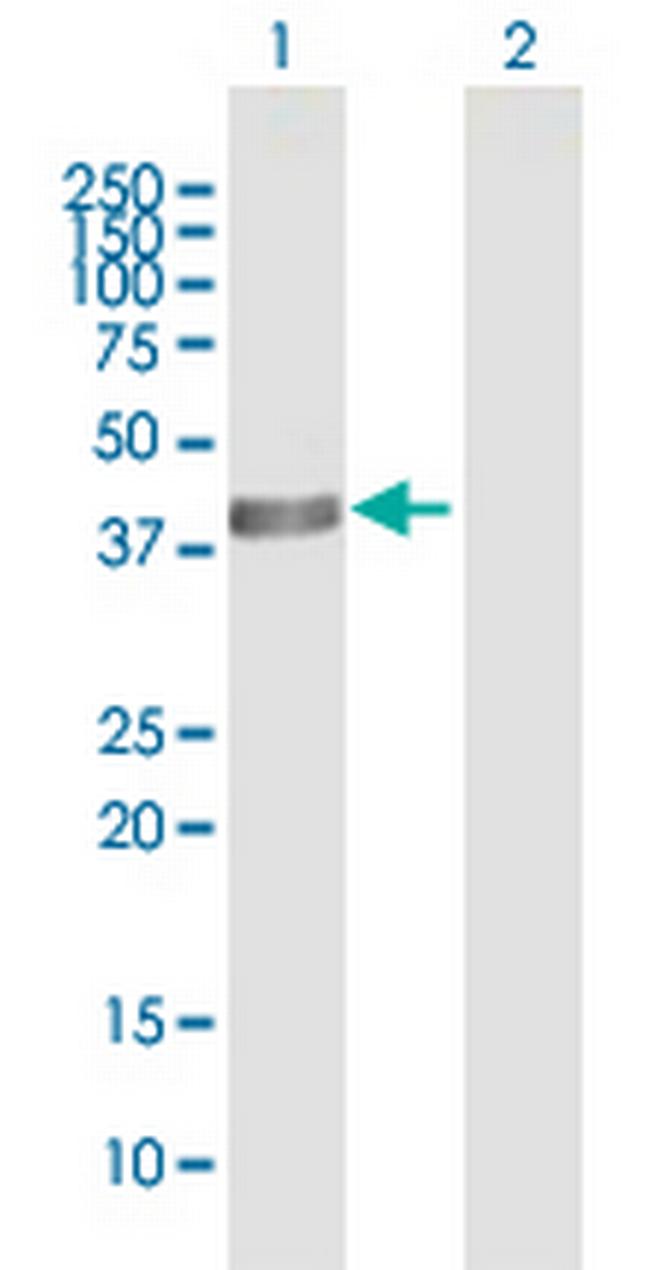 ACADS Antibody in Western Blot (WB)