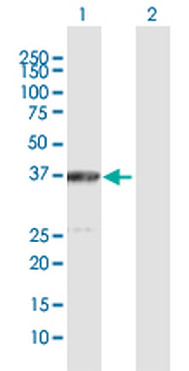 ACAT2 Antibody in Western Blot (WB)