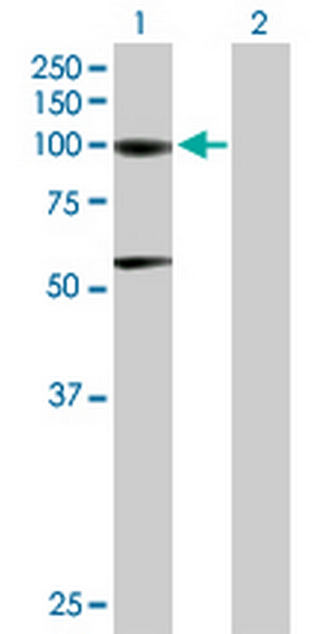 ACO1 Antibody in Western Blot (WB)