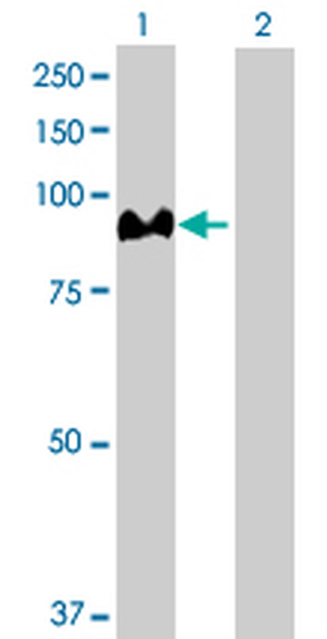 ACO1 Antibody in Western Blot (WB)