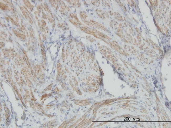 ACTB Antibody in Immunohistochemistry (Paraffin) (IHC (P))