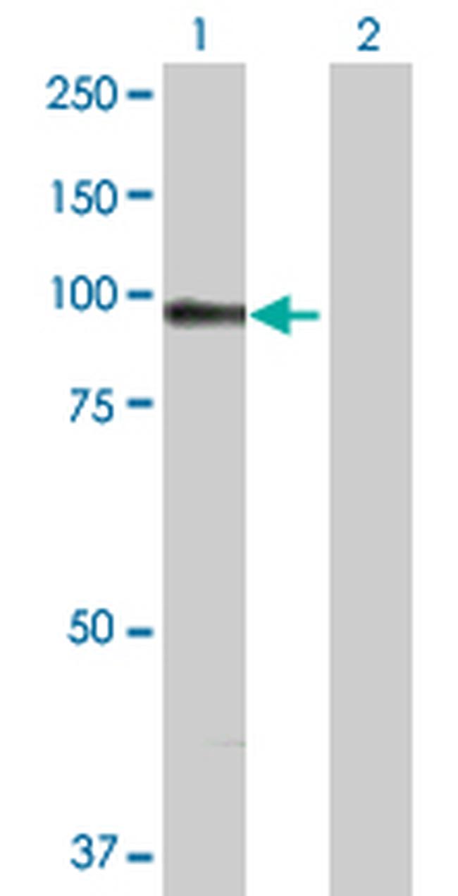 ACTN1 Antibody in Western Blot (WB)