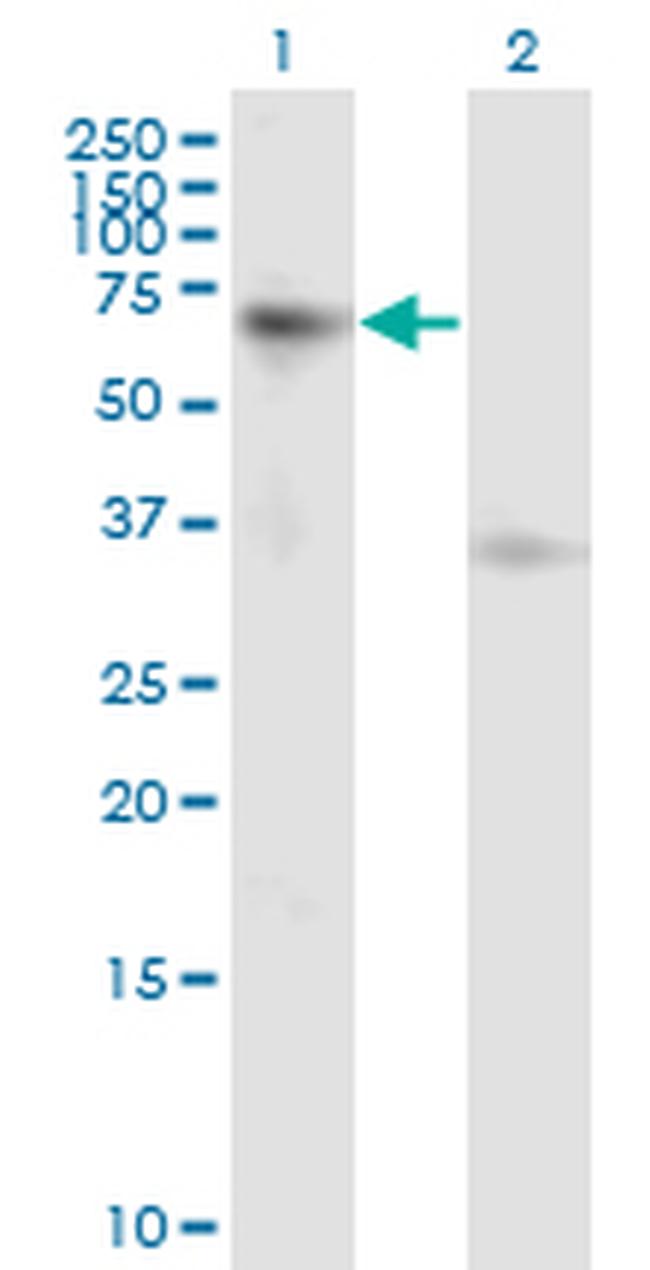 ACVR1B Antibody in Western Blot (WB)