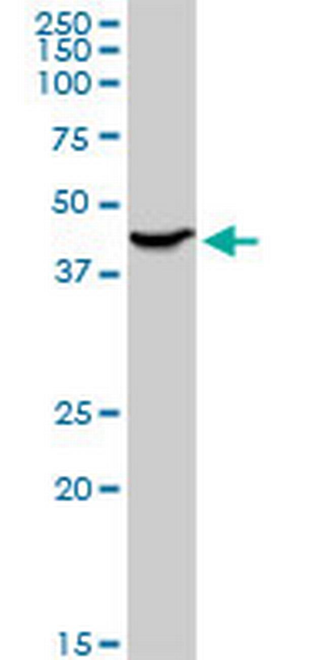 ADA Antibody in Western Blot (WB)