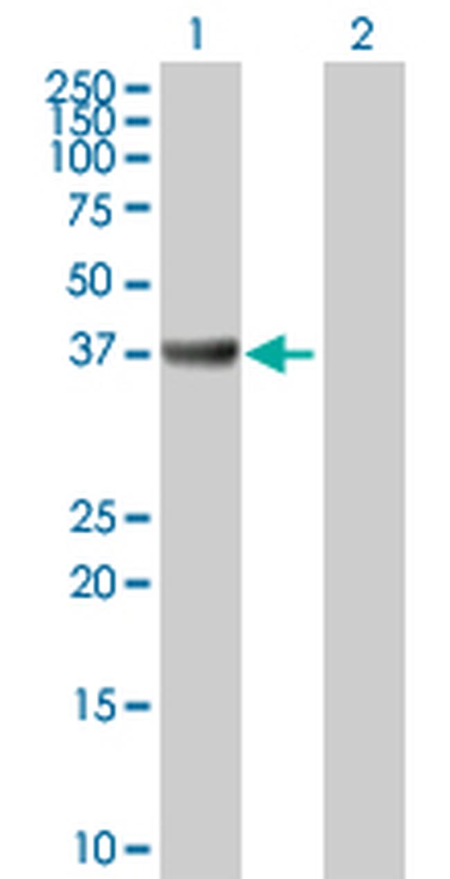 ADA Antibody in Western Blot (WB)