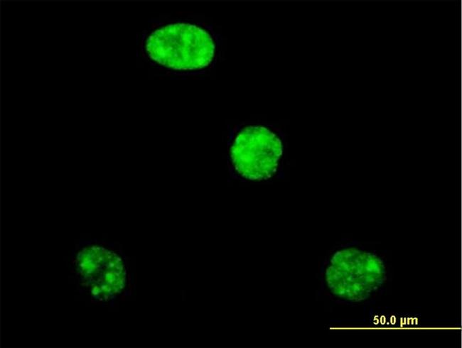 ADAR Antibody in Immunocytochemistry (ICC/IF)