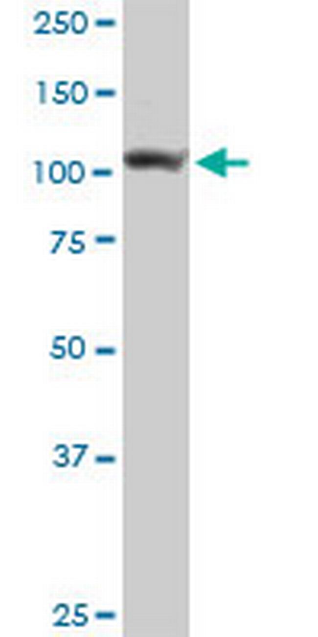 ADAR Antibody in Western Blot (WB)