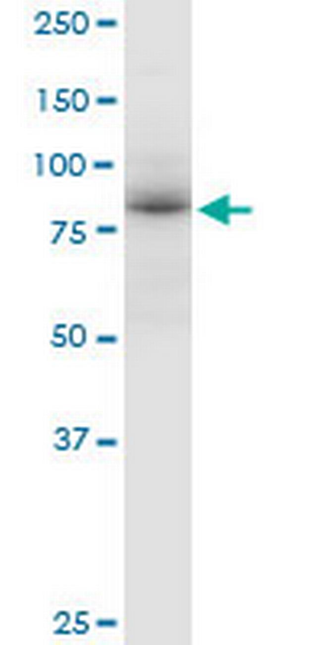 ADARB1 Antibody in Western Blot (WB)