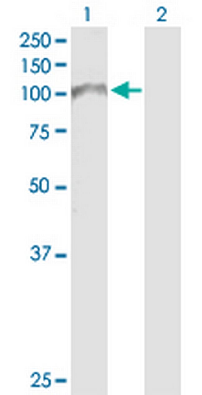 ADD2 Antibody in Western Blot (WB)