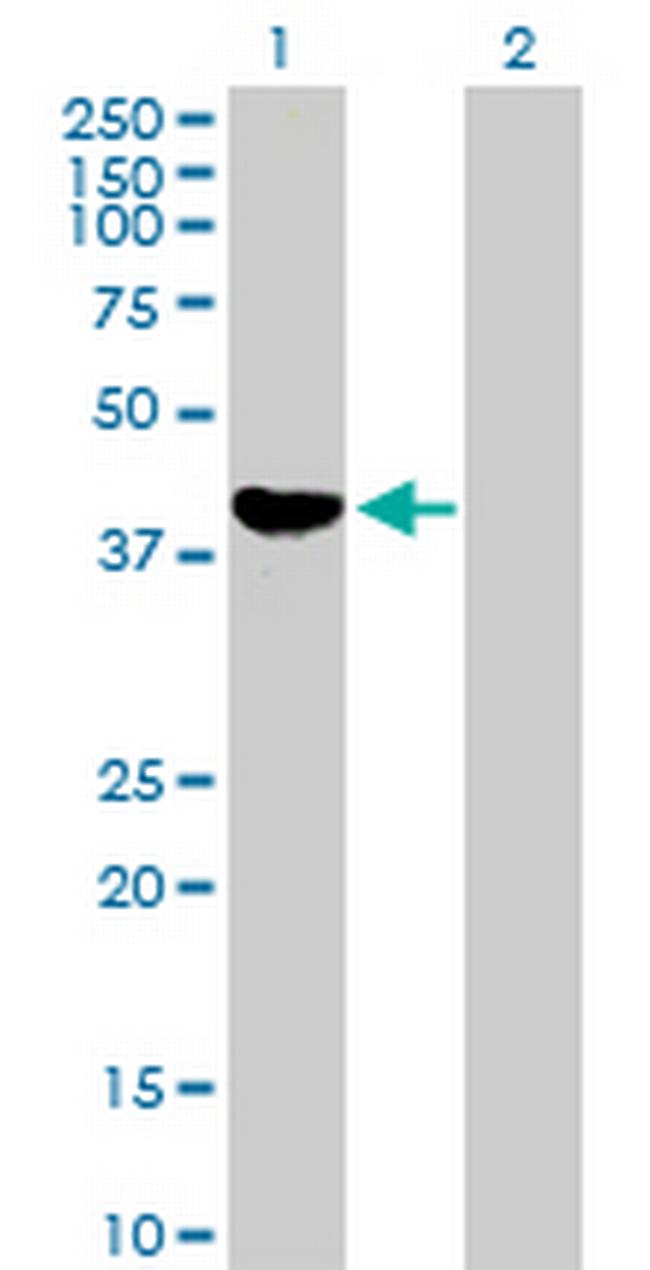 ADH1C Antibody in Western Blot (WB)