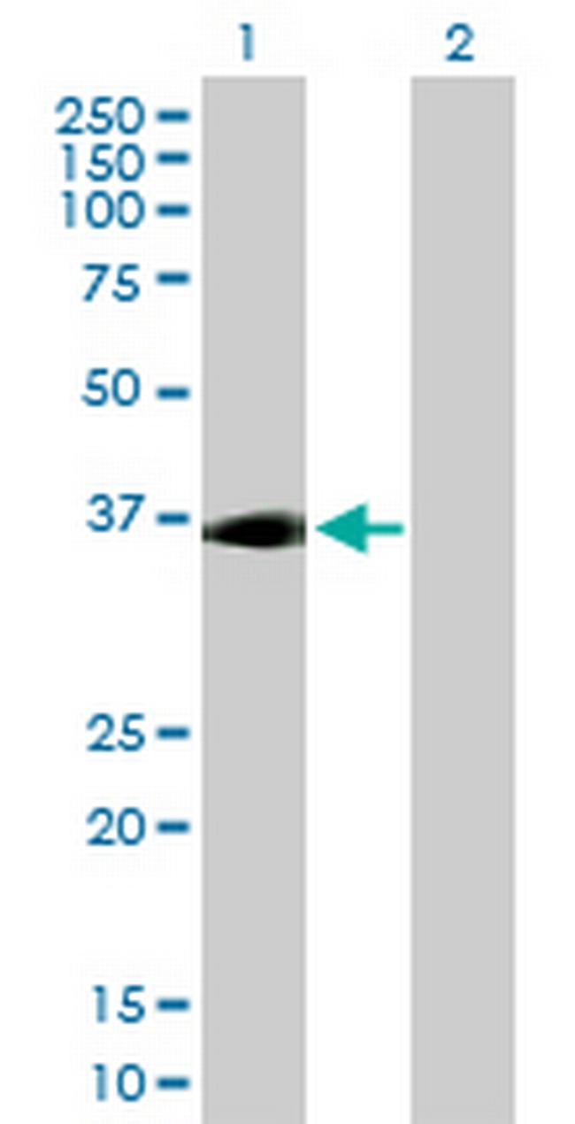 ADORA2A Antibody in Western Blot (WB)