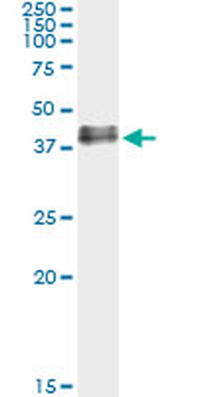 ADORA2A Antibody in Immunoprecipitation (IP)