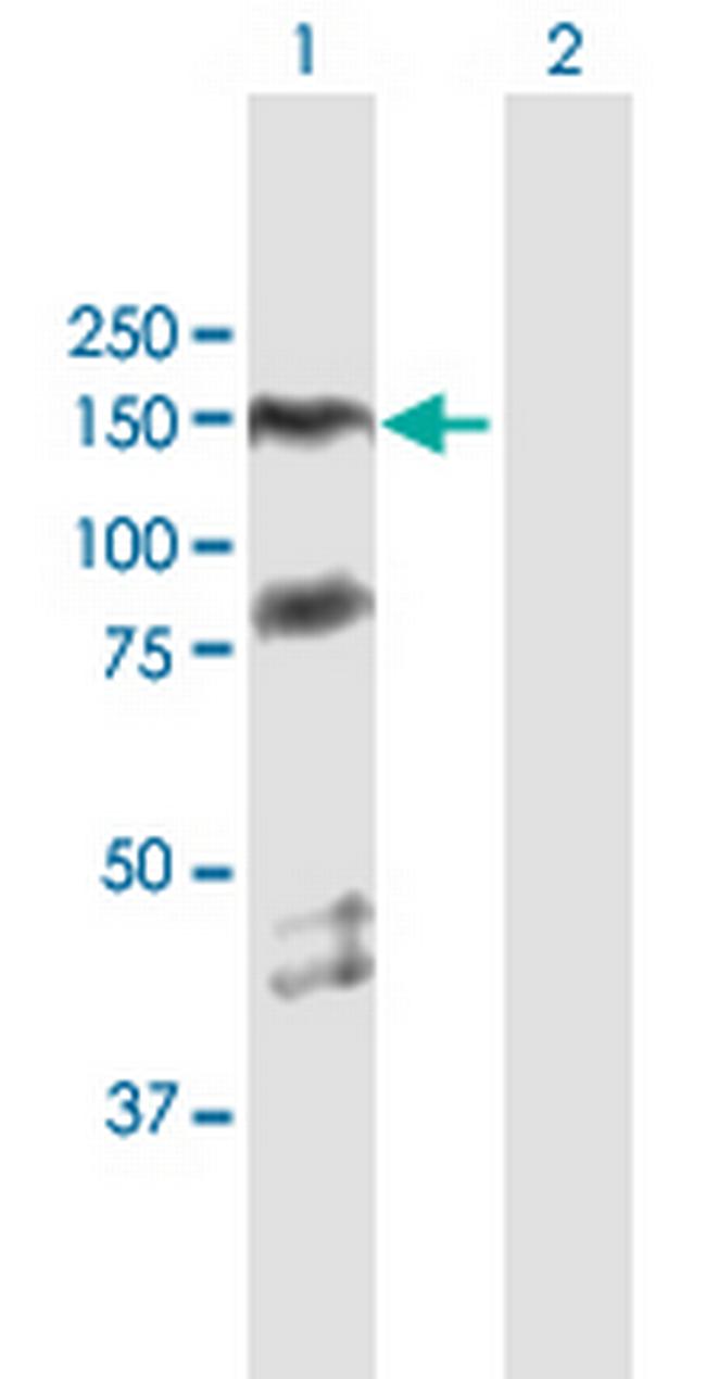 PARP1 Antibody in Western Blot (WB)