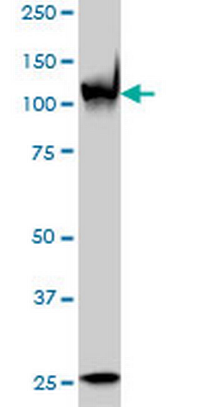 PARP1 Antibody in Western Blot (WB)