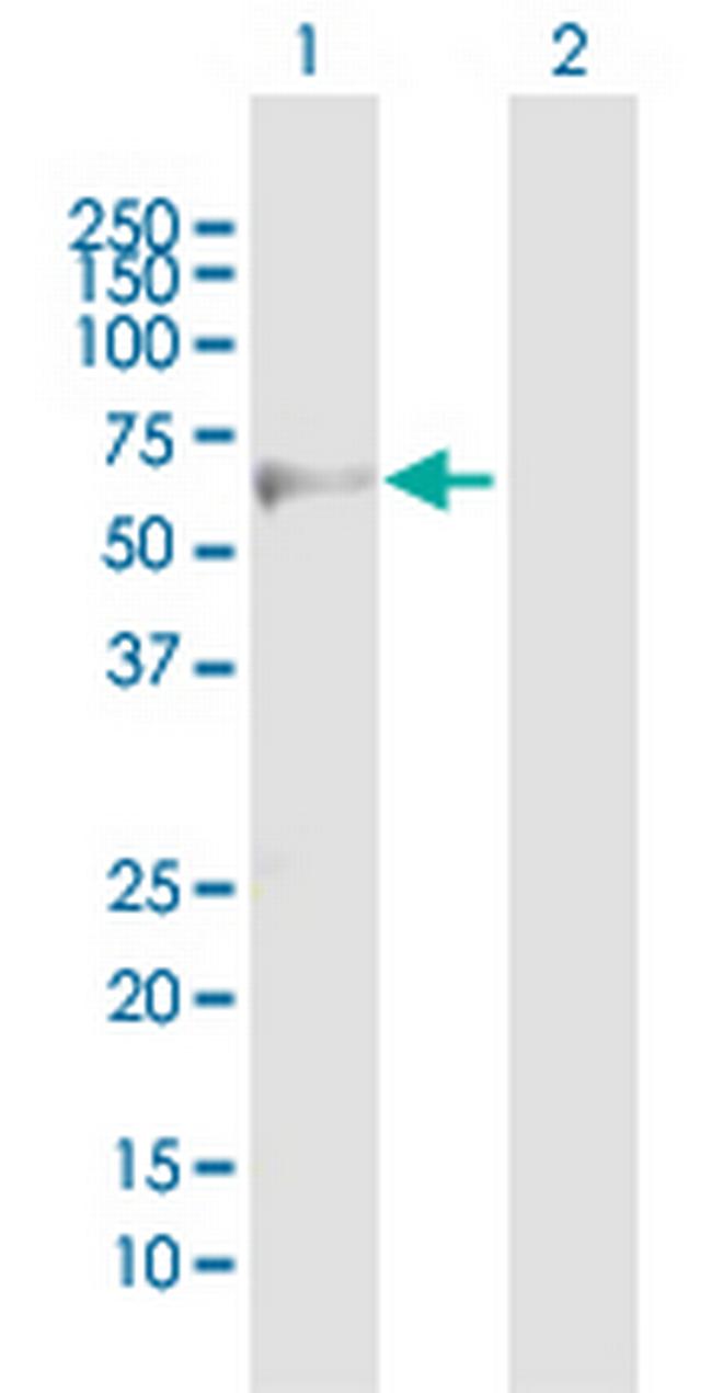 ADRB3 Antibody in Western Blot (WB)