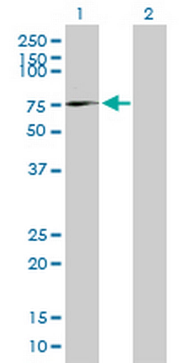 AFM Antibody in Western Blot (WB)