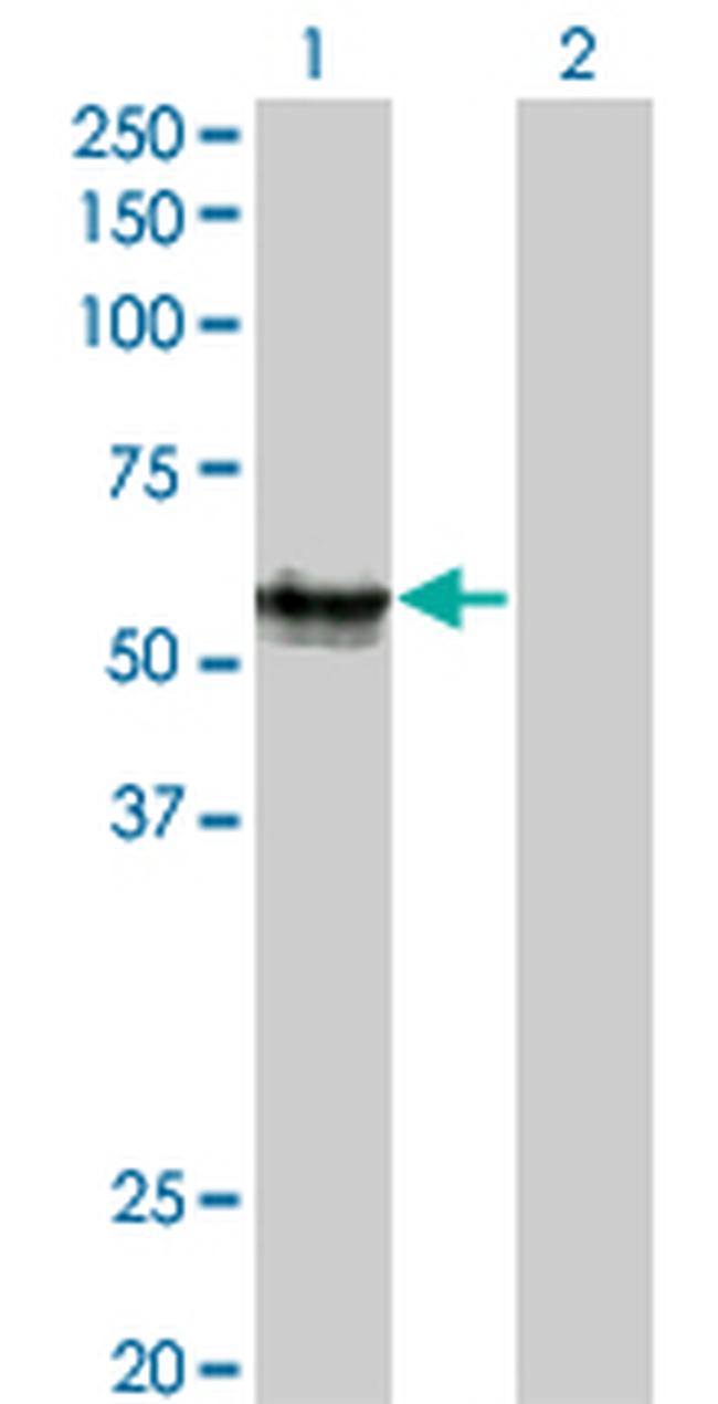 AGER Antibody in Western Blot (WB)