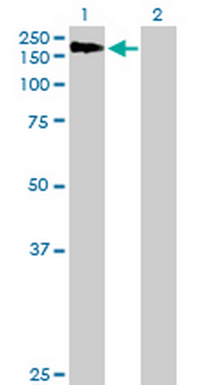 AGL Antibody in Western Blot (WB)