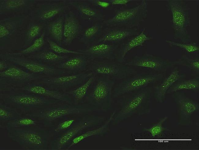 NR0B1 Antibody in Immunocytochemistry (ICC/IF)