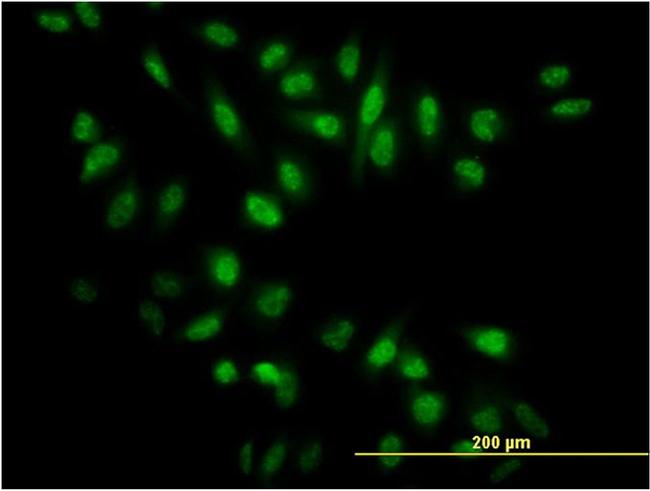 NR0B1 Antibody in Immunocytochemistry (ICC/IF)