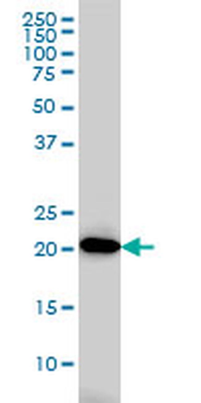 AK1 Antibody in Western Blot (WB)