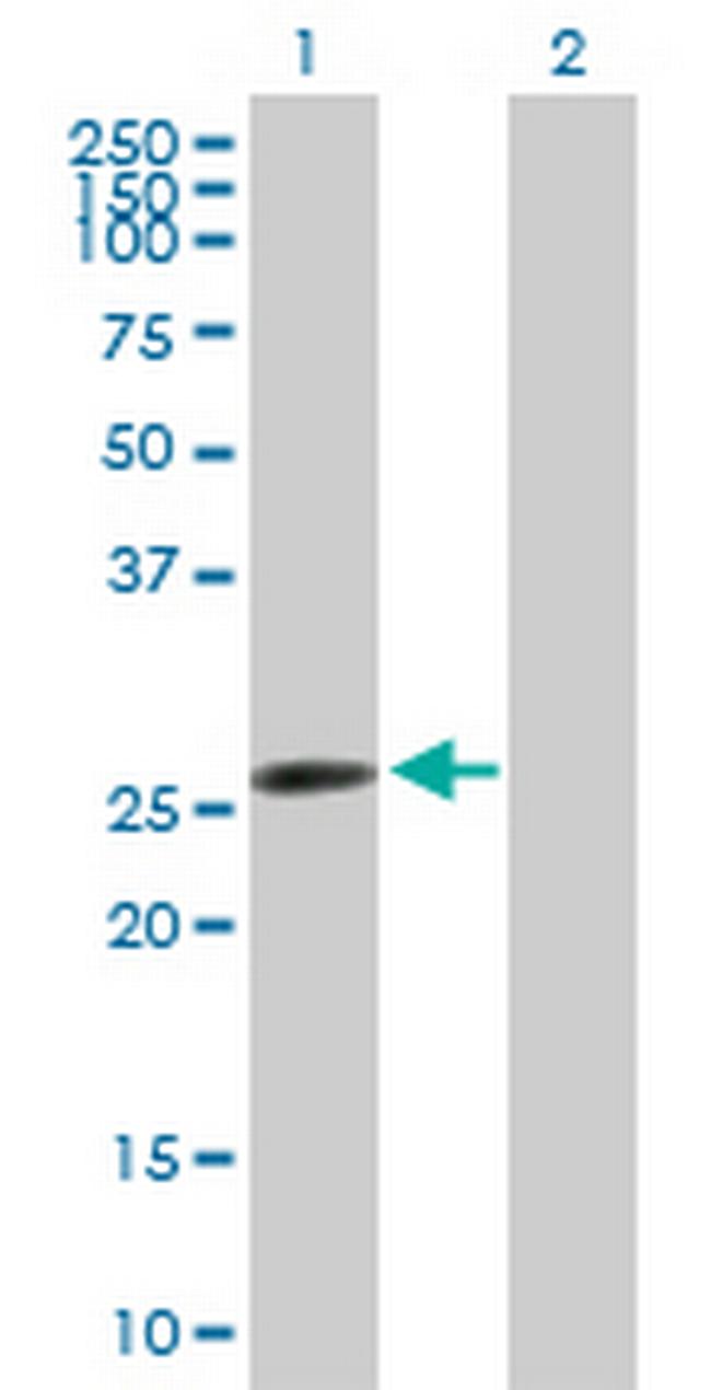 AK2 Antibody in Western Blot (WB)