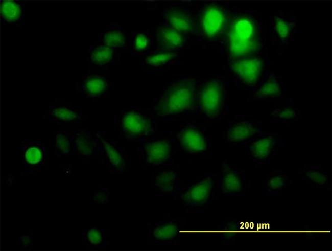 AKT1 Antibody in Immunocytochemistry (ICC/IF)