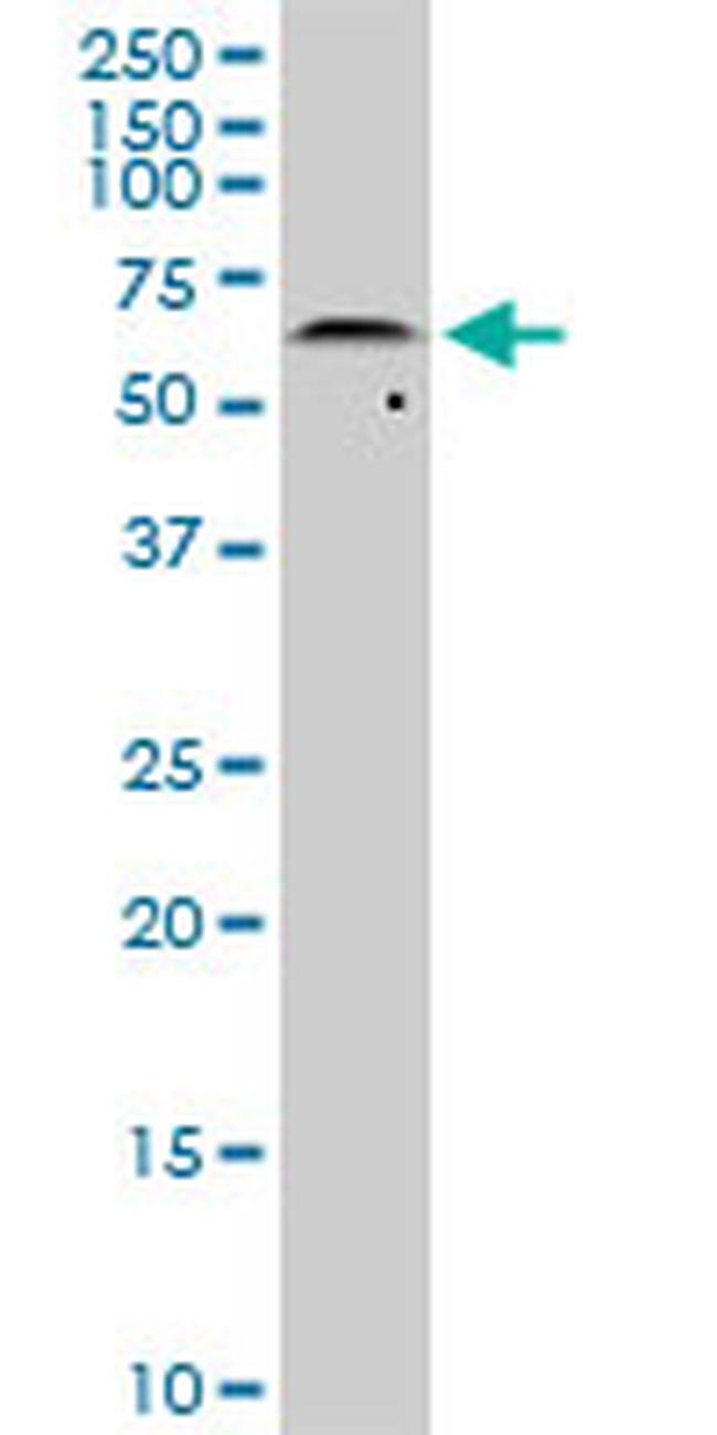 AKT2 Antibody in Western Blot (WB)