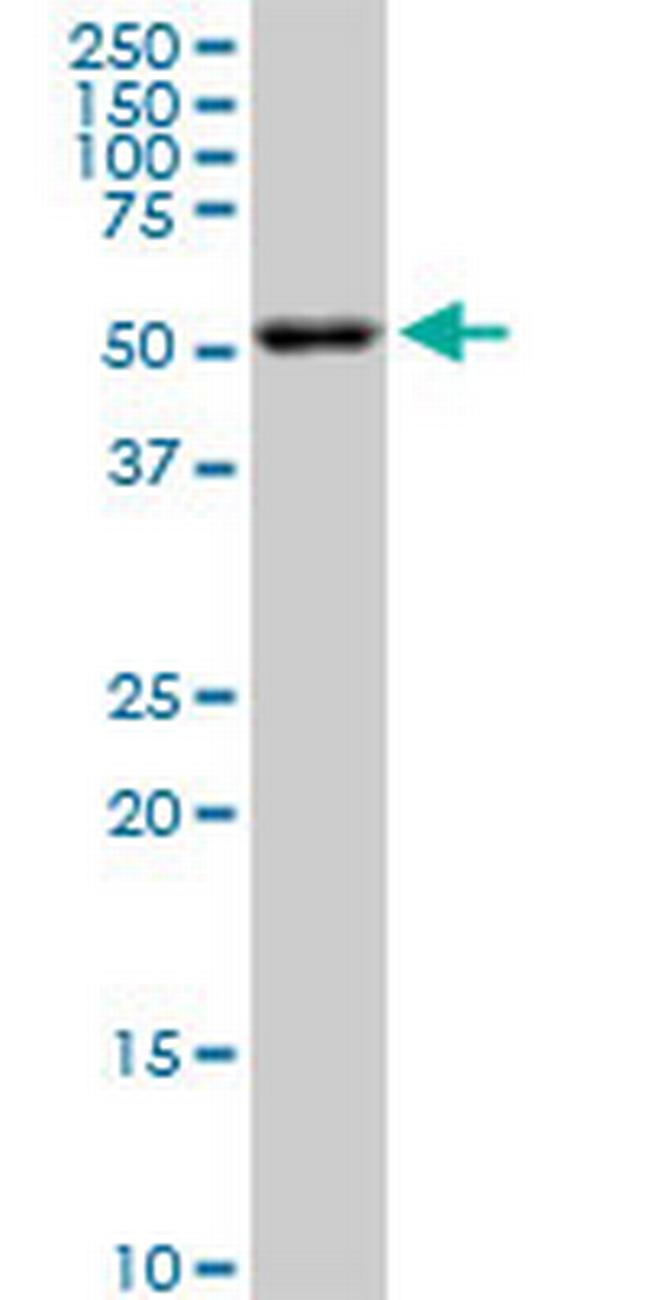 AKT2 Antibody in Western Blot (WB)