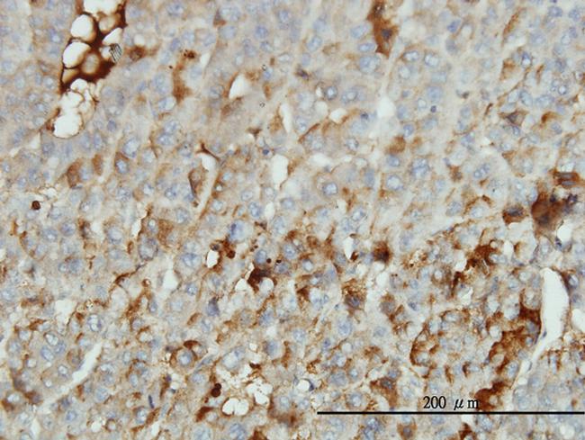 ALB Antibody in Immunohistochemistry (Paraffin) (IHC (P))