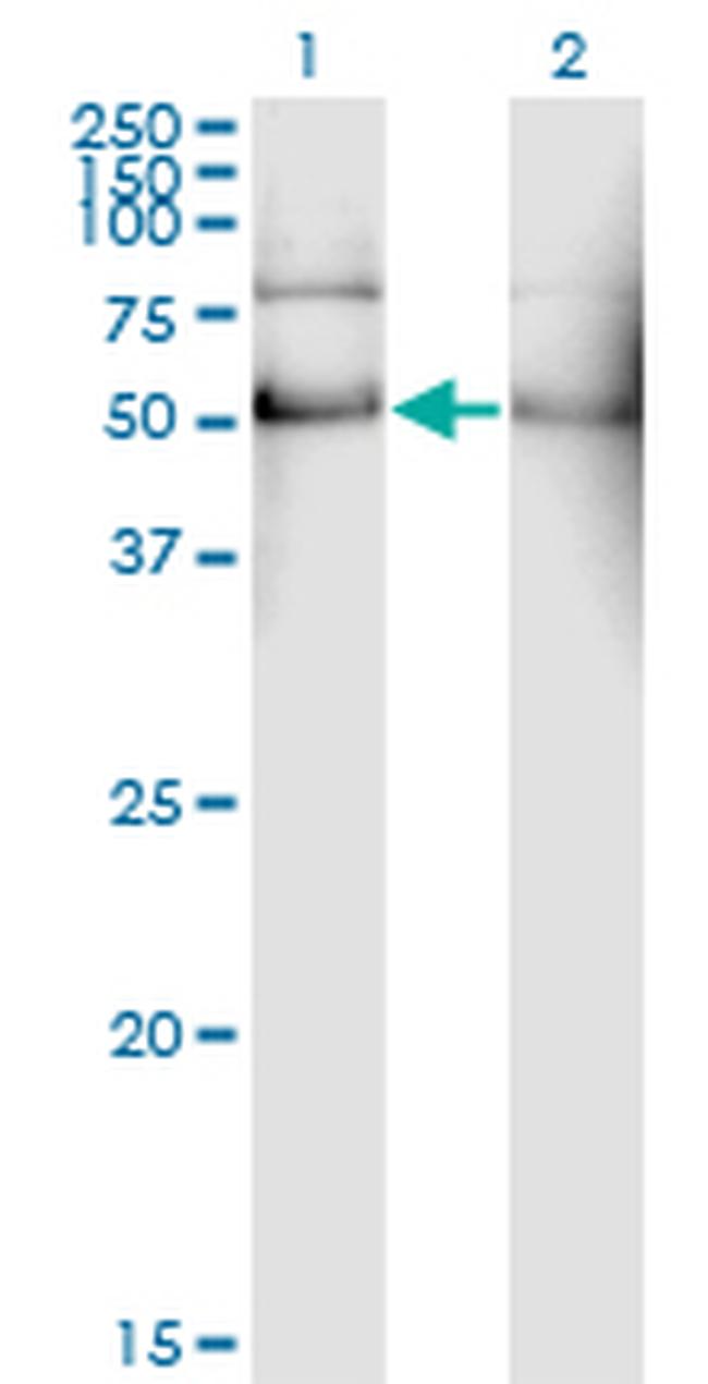 ALDH2 Antibody in Western Blot (WB)