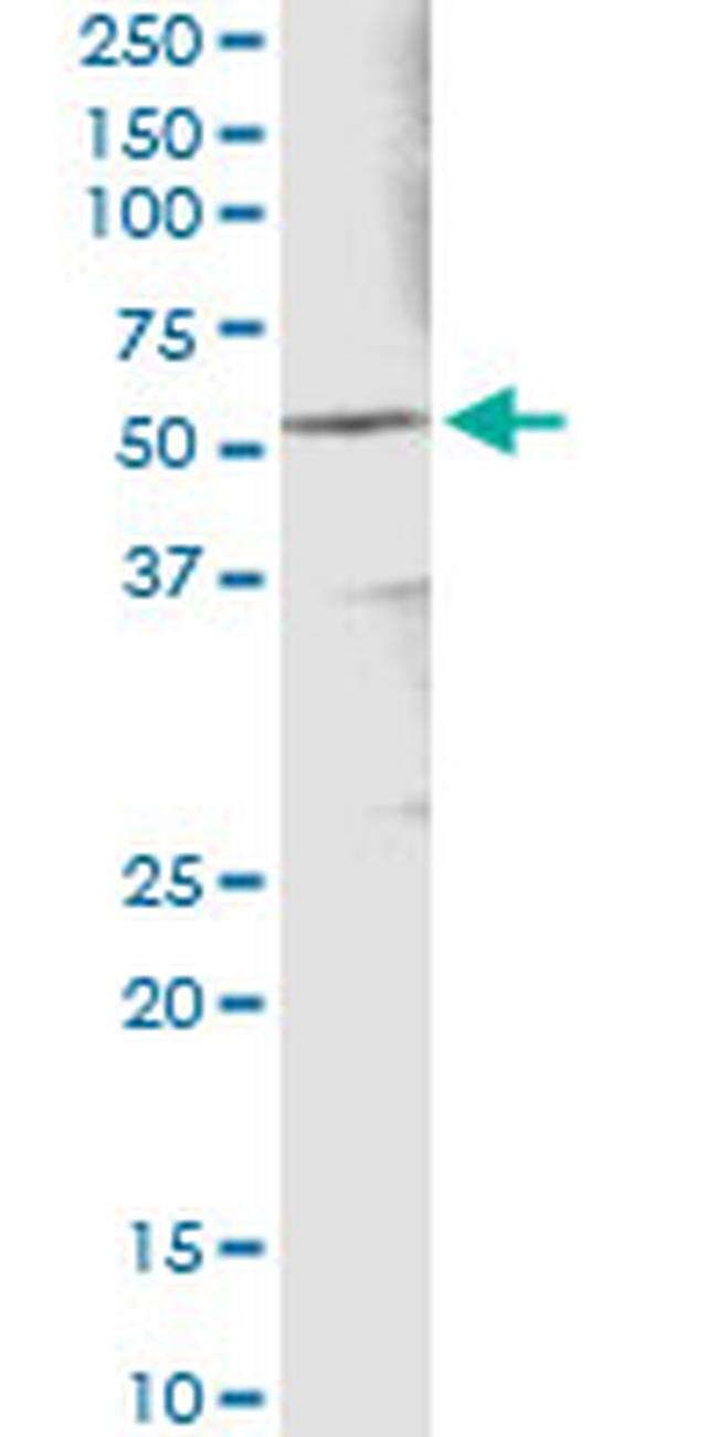 ALDH3A1 Antibody in Immunoprecipitation (IP)