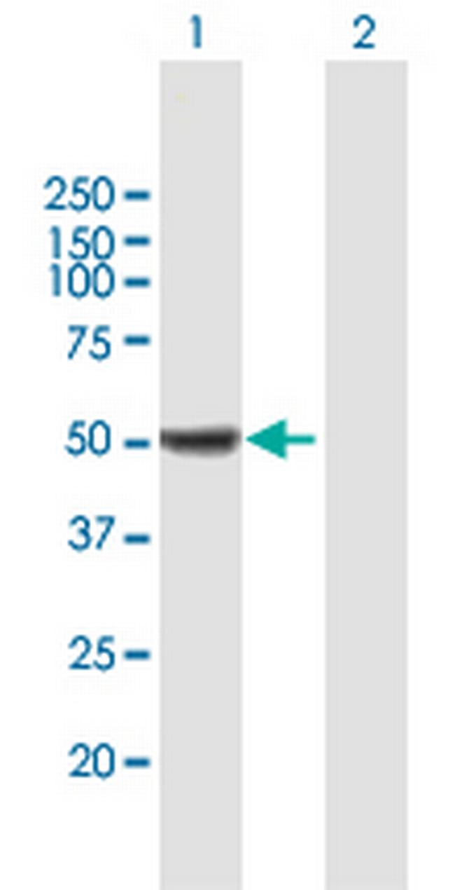 ALDH9A1 Antibody in Western Blot (WB)