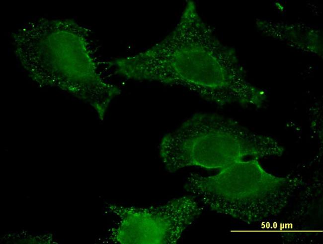 ALDH9A1 Antibody in Immunocytochemistry (ICC/IF)