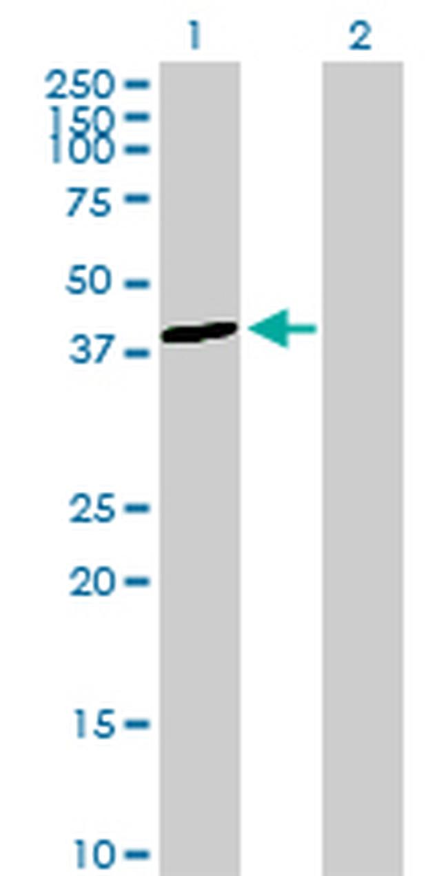 ALDOB Antibody in Western Blot (WB)