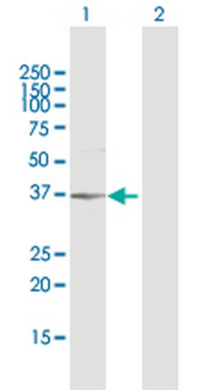 AKR1B1 Antibody in Western Blot (WB)