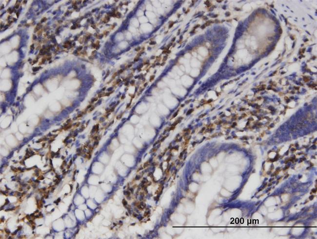 AKR1B1 Antibody in Immunohistochemistry (Paraffin) (IHC (P))