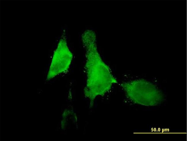 ALOX12 Antibody in Immunocytochemistry (ICC/IF)