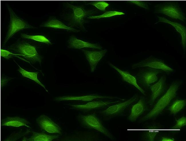 ALOX15B Antibody in Immunocytochemistry (ICC/IF)