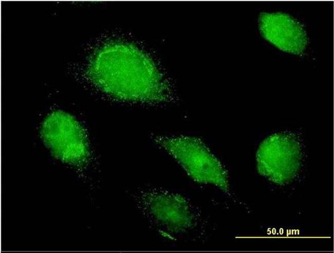 AMBP Antibody in Immunocytochemistry (ICC/IF)