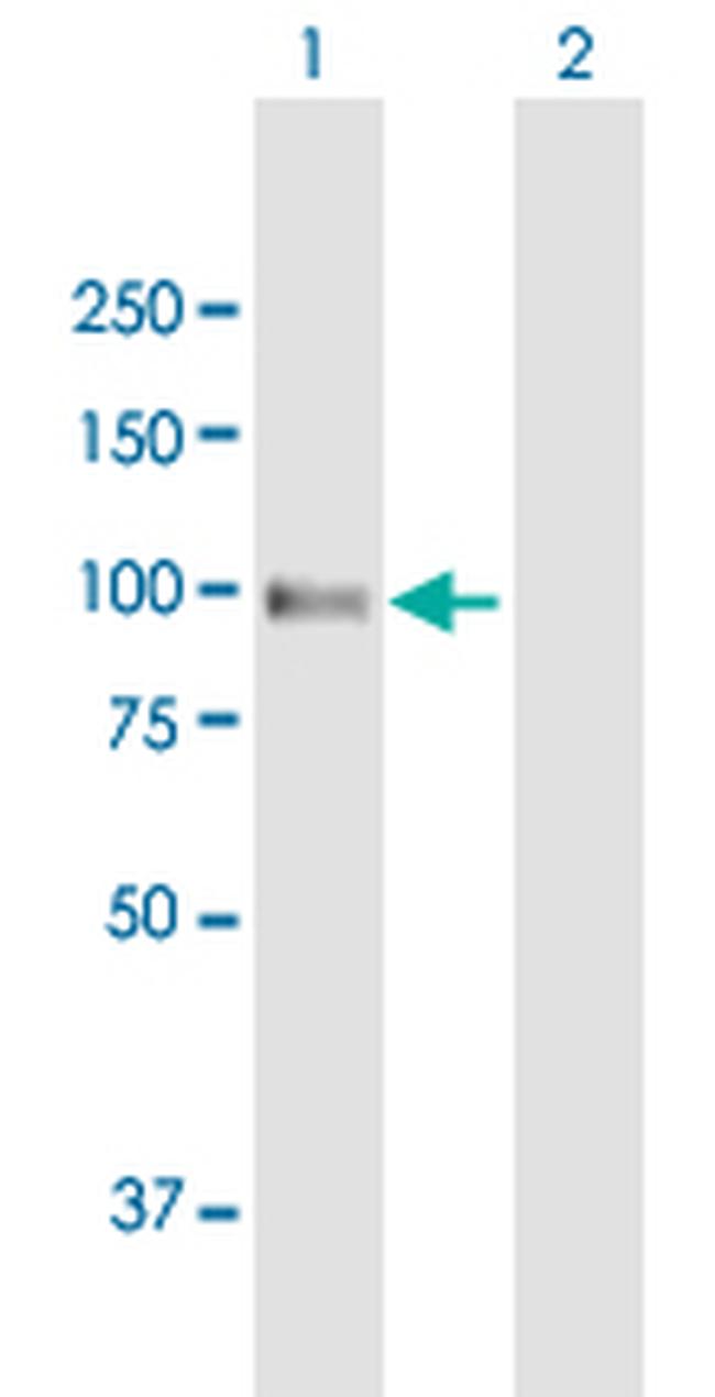 AMPD2 Antibody in Western Blot (WB)