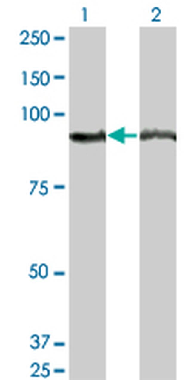 AMPD2 Antibody in Western Blot (WB)