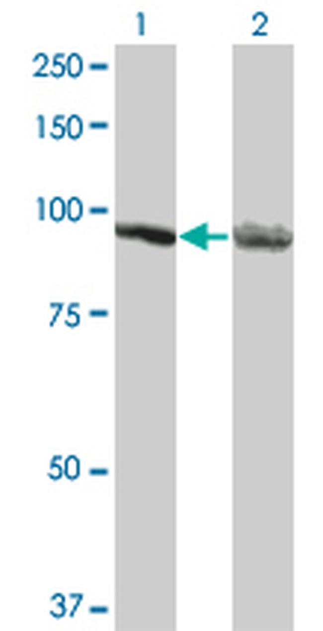 AMPD2 Antibody in Western Blot (WB)