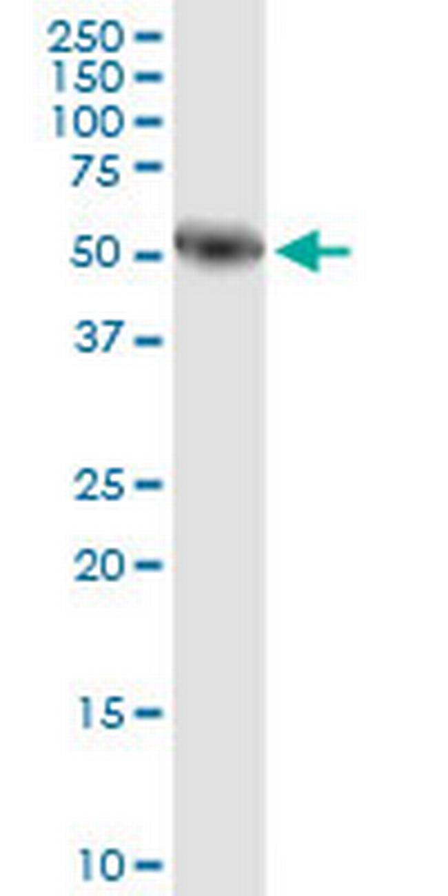 AMY1A Antibody in Western Blot (WB)