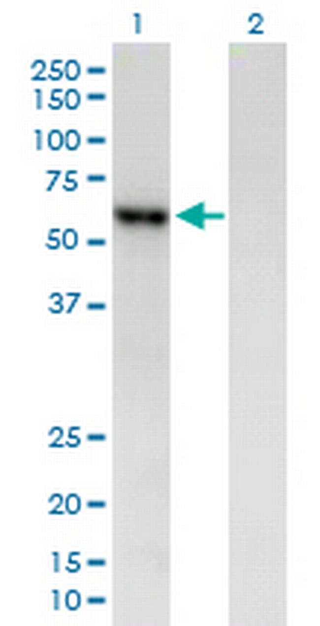 AMY2B Antibody in Western Blot (WB)